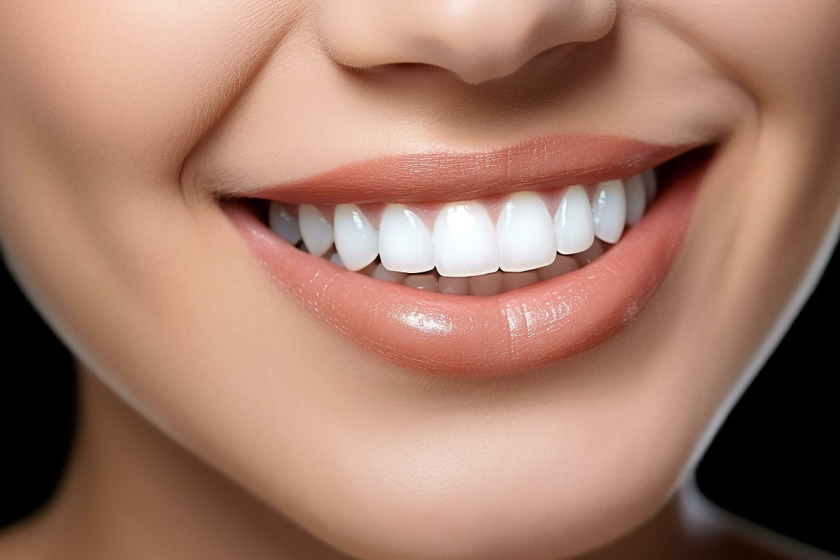 Smile 1
